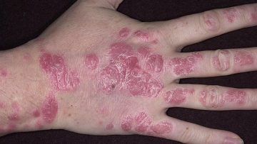 Photo: ${params.title}