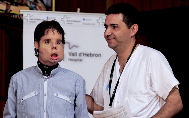 A 30-member medical team led by the Spanish doctor Joan Barret, right, carried out the world&rsquo;s first full-face transplant on Oscar at the Vall d'Hebron Hospital in Barcelona. Oscar was injured in a shooting accident five years ago. (AP)