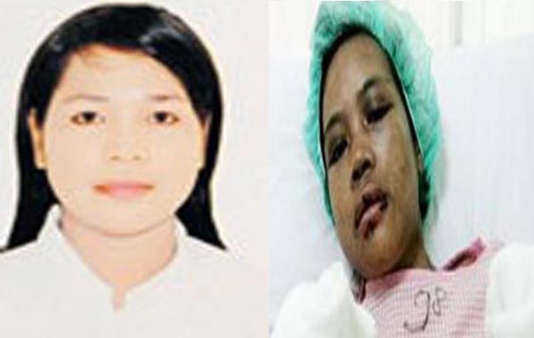 The Indonesian woman before and after she was tortured. (SUPPLIED)