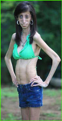 Lizzie Velasquez (INTERNET SOURCE)
