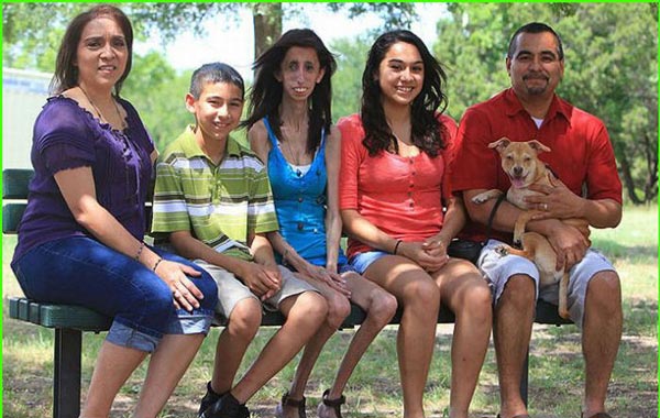 Lizzie Velasquez (INTERNET SOURCE)