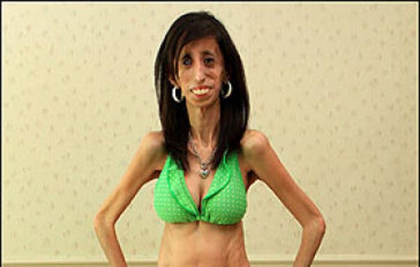 Lizzie Velasquez (INTERNET SOURCE)
