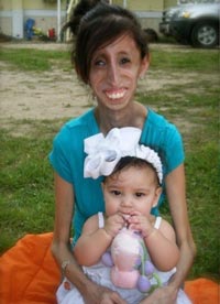 Lizzie Velasquez (INTERNET SOURCE)