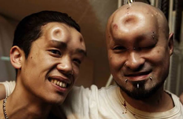 Bagels are a delicious breakfast treat that can be enjoyed anytime. Not only are they delicious but they have that particular shape. The thick ring has now even been an inspiration to extreme body modifications, particularly subdermal implants. The implants are made from saline injected under the skins, thus classifying them as subdermal implants. They could also be saline injected into bags and placed under skin in desired implants. They can be in various sizes and there can be multiple &ldquo;bagels&rdquo; on a person. (AGENCY)