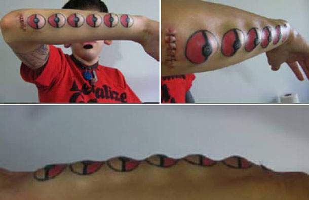 Most bizarre body implants - Emirates24|7