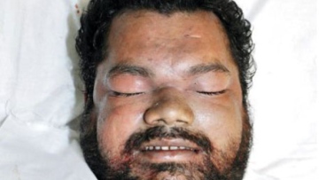 Photo: ${params.title}