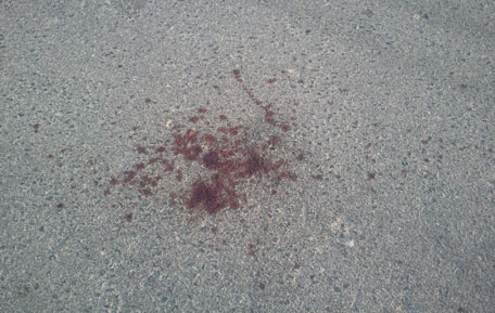 Blood left on the streets after a couple living in Springs allegedly took their fight outdoors. (Shuchita Kapur)