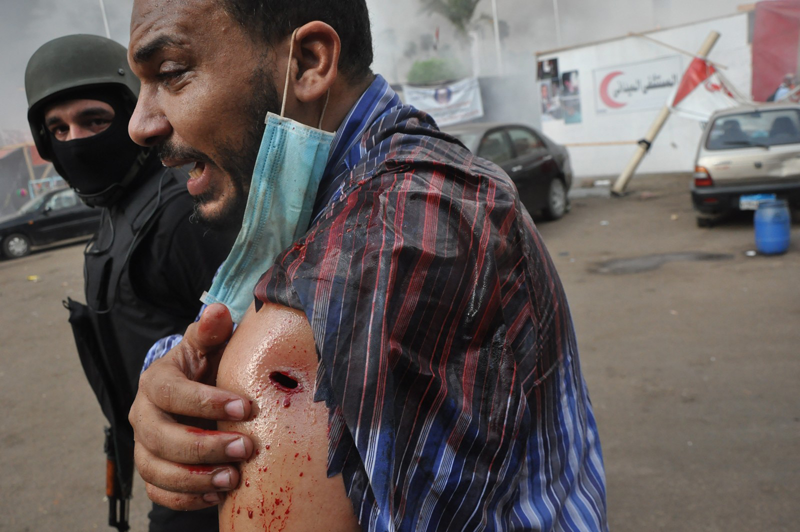 An Egyptian security force escorts a supporter of ousted Islamist President Mohammed Morsi as security forces clear a sit-in camp set up near Cairo University in Cairo's Giza district, Egypt, Wednesday, Aug. 14, 2013. Egyptian police in riot gear swept in with armored vehicles and bulldozers Wednesday to clear the sit-in camp and the other encampment set up by supporters of the country's ousted Islamist president in Cairo, showering protesters with tear gas as the sound of gunfire rang out. (AP)