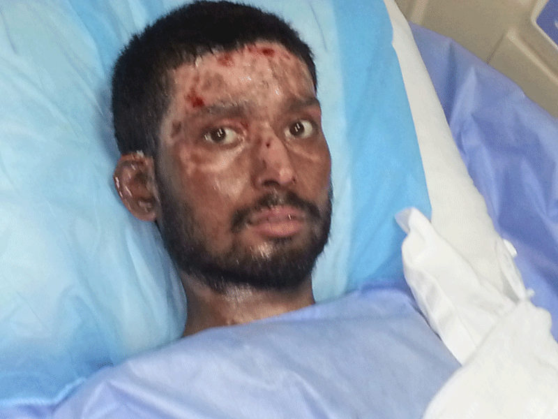 Satya Dev, one of the victims of the cargo ship fire, recovering in a hospital in Sharjah.