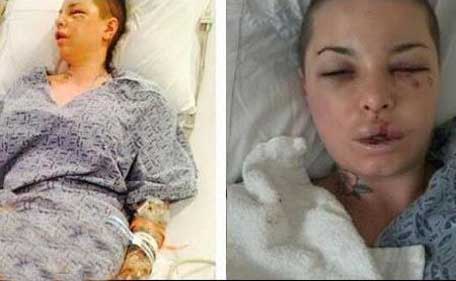 Christy Mack on her hospital bed after being allegedly attacked by her boyfriend Jonathan Koppenhaver. (Twitter@ChristyMack)