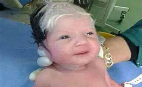 Syrian baby born with grey hair in Lebanon - News - Emirates24|7