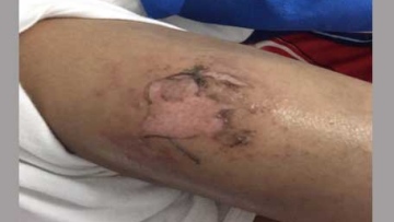 Photo: ${params.title}