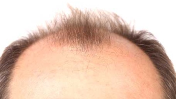 Photo: ${params.title}