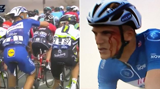 Kittel re-enacts the punch, and blood is seen streaming down his face. Pic: Twitter