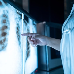 Photo: Scientists Discover Main Driver of Early-Stage Lung Cancer