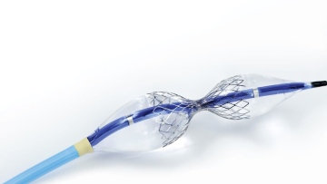 Photo: Cleveland Clinic Abu Dhabi Implants First Device to Treat Severe Angina